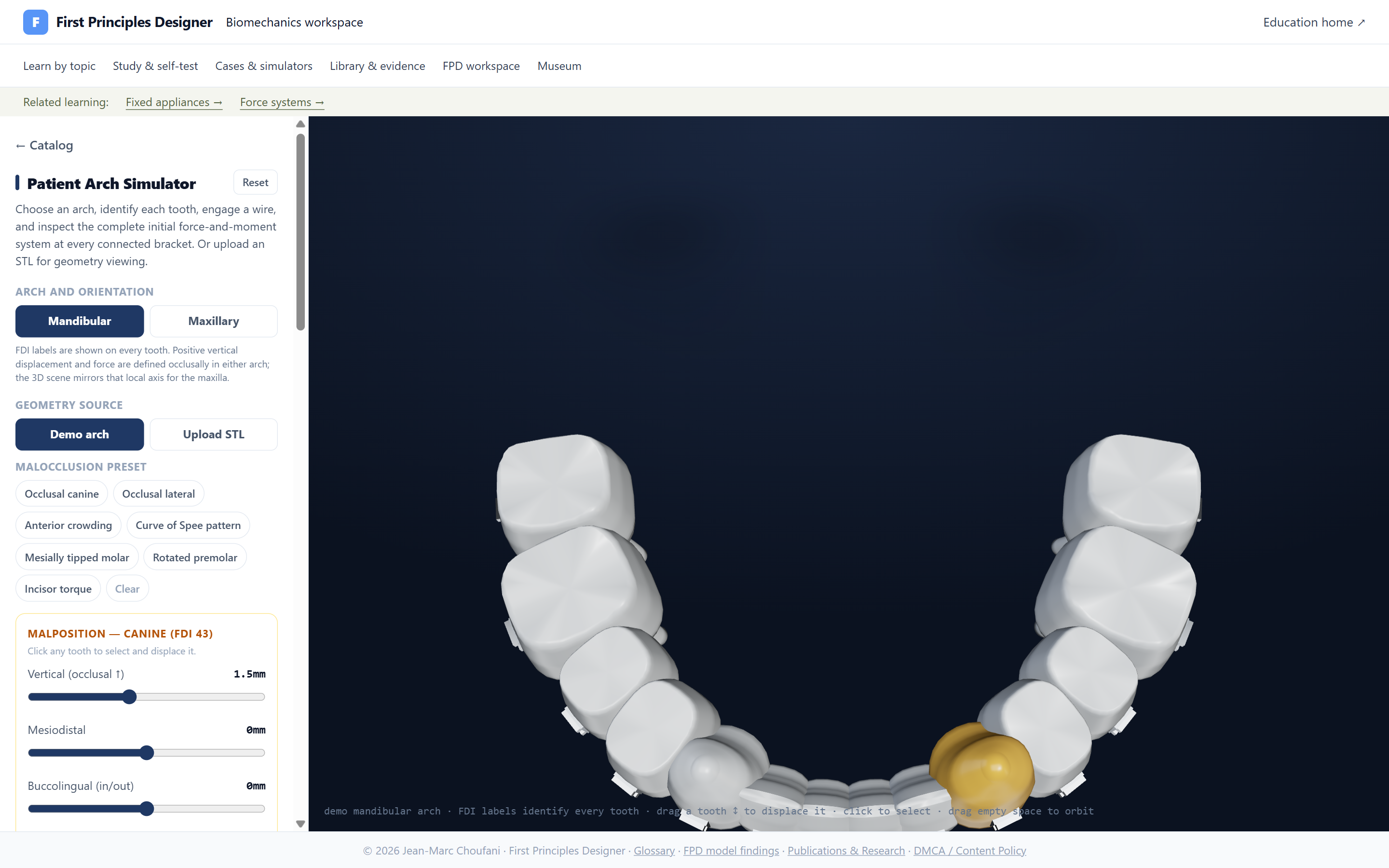 The live Patient Arch Simulator: a full 3D mandibular arch with FDI-labelled teeth, malocclusion presets, and per-tooth displacement controls for inspecting the whole-arch force system.